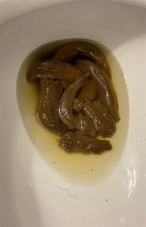 rate my poop|Rate My Poo: r/RateMyPoop on Reddit Is Thriving in。